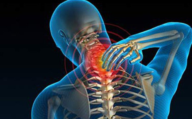 Thoát vị đĩa đệm đốt sống cổ - Hình ảnh minh họa